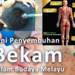 Bekam Budaya Melayu